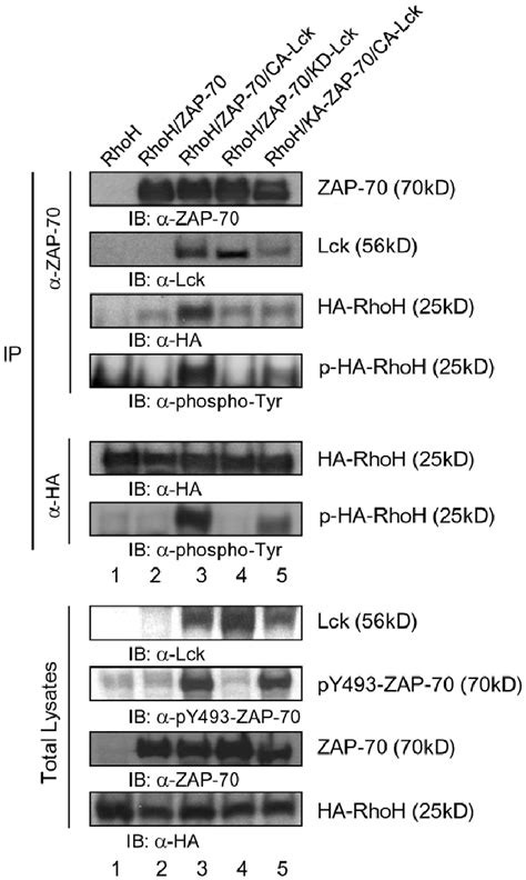 Both Zap 70 And Lck Kinase Activities Are Required For The Association