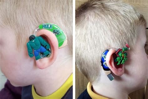 Mom Creates Awesome Superhero Hearing Aids For Kids