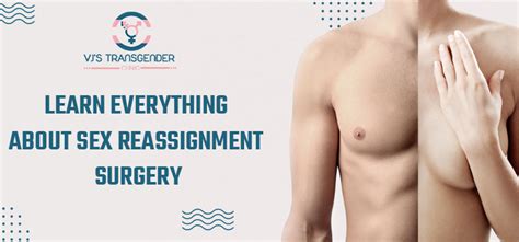 Sex Reassignment Surgery What It Is And Its Different Types