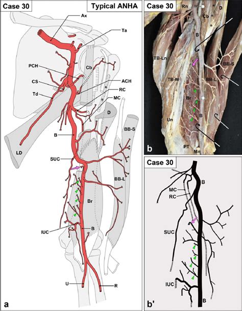Printiable Mape Of Arteries And Viens Cardiovascular Media Library
