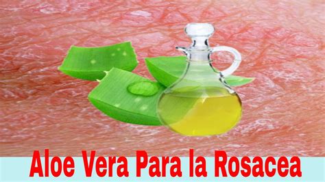 Qué Tan Efectivo Es El Aloe Vera Para La Rosácea Youtube