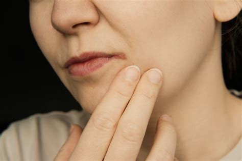 Causes Prevention And Treatment For Cold Sore On The Skin Saturn By Ghc
