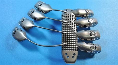 Worlds First 3d Printed Titanium Rib Cage Is Simply Majestic