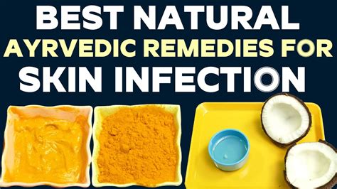 Best Ayurvedic Remedies For Skin Infection Natural Ayurvedic Total