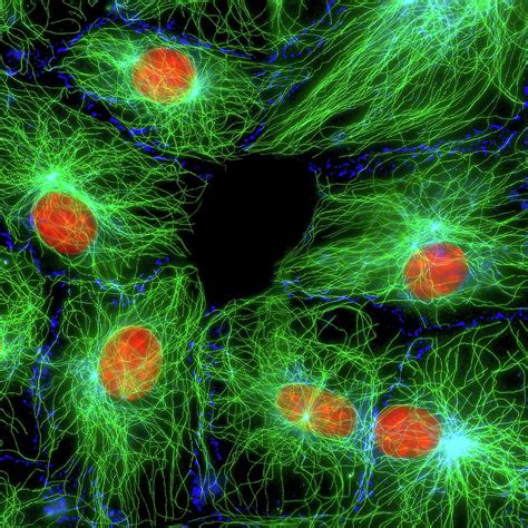 Fibroblast Cells Photograph By Dr Jan Schmoranzerscience Photo Library