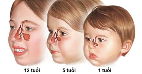 Symptoms Of Cellulitis In Nose The Request Could Not Be Satisfied