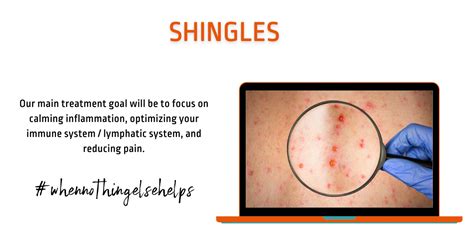can anf therapy®️ help with issues related to shingles anf therapy