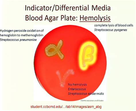 Beta Hemolysis On Blood Agar Cloudshareinfo