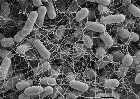 Salmonella typhi causes typhoid fever; RKI - EM-Aufnahmen - Salmonella enterica