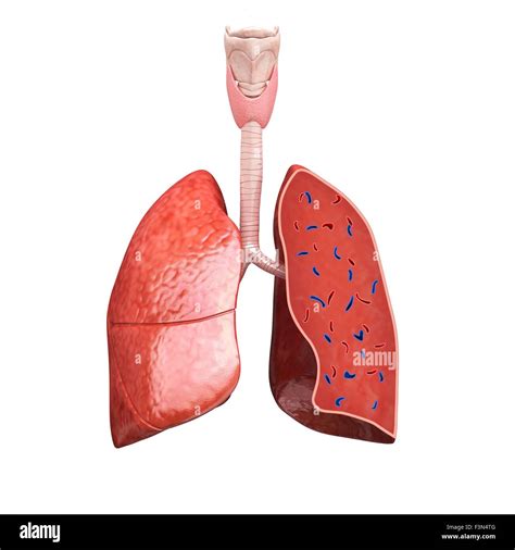 Cross Section Of The Lungs Hi Res Stock Photography And Images Alamy