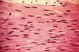Pictures of Where Can Smooth Muscle Be Found