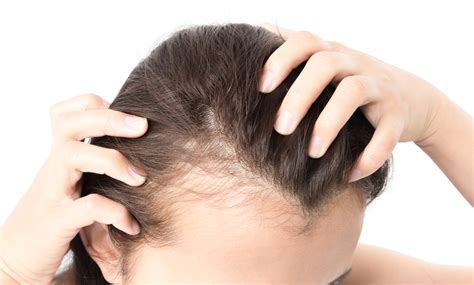 Best receding hairline treatments for men and women to recover from age, lifestyle, and medical hair loss. PRP Injection | Hair Loss Treatment Nashua NH | Boston MA