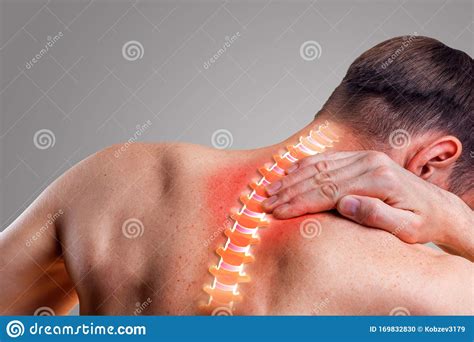 Pain In The Cervical Spine Symptom Of Cervical Chondrosis Stock Photo