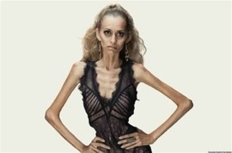 Anti Anorexia Ads Stun With Tagline You Are Not A Sketch Photos