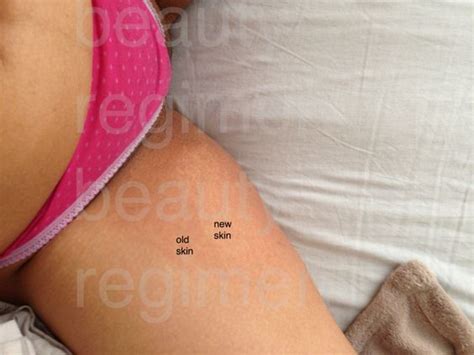 The Possible Causes Of Skin Discoloration In The Groin Heidi Salon