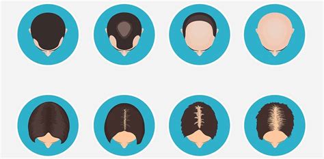Today i'll review the best hair growth products for men. 15 Best Hair Growth Products for Men & Women That Work 2019