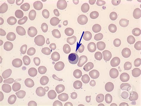 Some of these differences can be clearly understood when the cells. Nucleated red blood cell - 1.