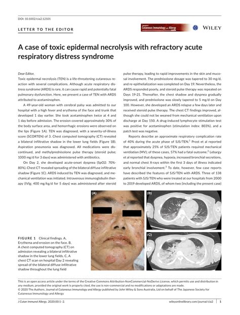 Pdf A Case Of Toxic Epidermal Necrolysis With Refractory Acute