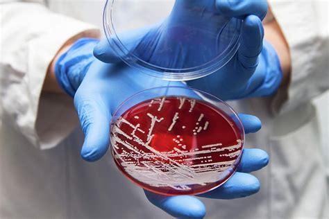 Staphylococcus Aureus Culture Photograph By Daniela Beckmann Science