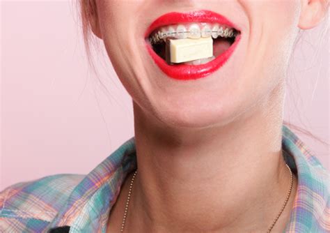 Not So Sweet Sweets The Five Worst Candies To Eat During Orthodontic