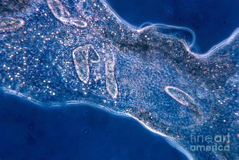 Amoeba Eating Paramecium Photograph By Eric V Grave