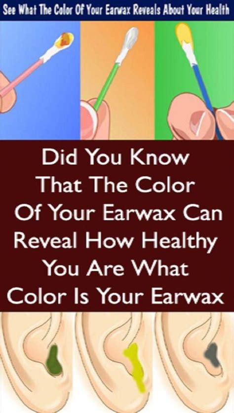 Your Earwax Can Tell How Healthy You Are What Color Is Yours In 2020