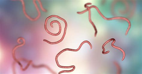 Pinworm Infection Symptoms Treatment Infestation And Causes