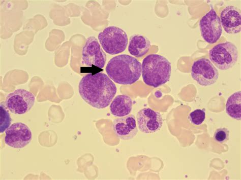 Granulocytes And Granulocyte Maturation A Laboratory Guide To