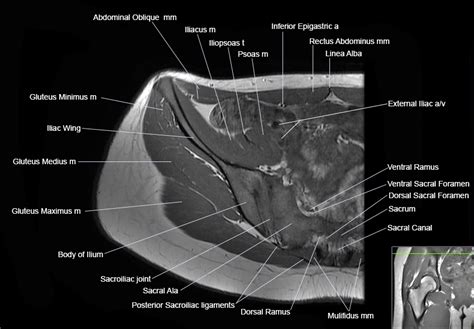 Ct Pelvis Anatomy Muscles Mri Anatomy Of Hip Joint Free Mri Axial