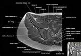 Anatomy muscle pelvis illustrations & vectors. Pelvic Anatomy Radiology - Human Body Anatomy