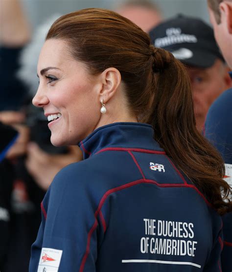 Kate Middleton Has A Massive Scar On Her Face That You Probably Never Noticed Before Iheart