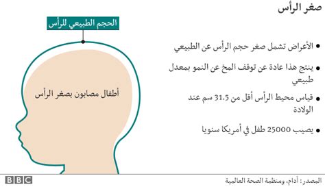 مرض فيروس زيكا هو مرض ينجم عن فيروس ينتقل عبر البعوض ، ويؤدي لأعراض مثل الحمى والطفح الجلدي، وتشير تقارير إلى وجود صلة محتملة بين إصابة الحوامل به وإنجاب أطفال يعانون من التشوه الخلقي الصعل (microcephaly) وهو صِغر الرأس، ولا يوجد حاليا علاج أو تطعيم لفيروس زيكا. فيروس زيكا حقائق ومعلومات والعلاج في الطب البديل