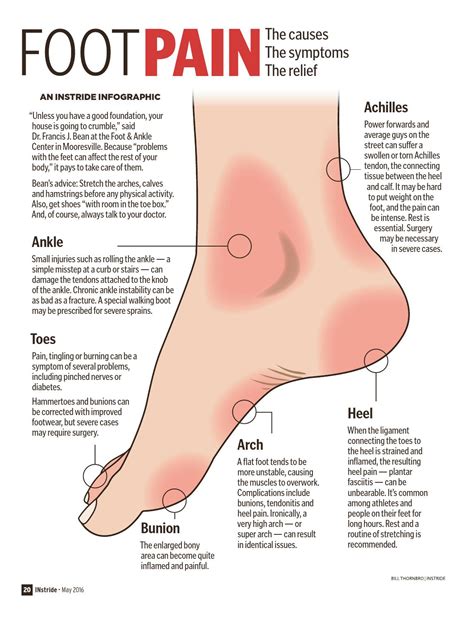 High Ankle Sprain Diagram