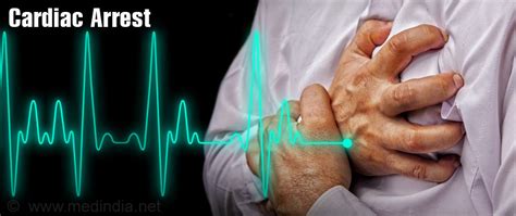 Cardiac arrest is an extreme and sudden medical emergency and condition where the heart stops. Therapeutic Hypothermia