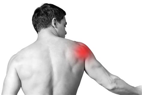 Rotator Cuff Injury Symptoms Treatment By Lubbock Sports Medicine