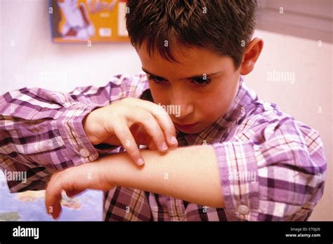 Itching In A Child Stock Photo Alamy
