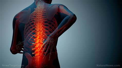 Ankylosing Spondylitis Causes Side Effects And Treatments At