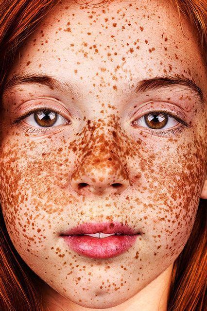Breathtaking Photo Series Shows The Undeniable Beauty Of Freckles