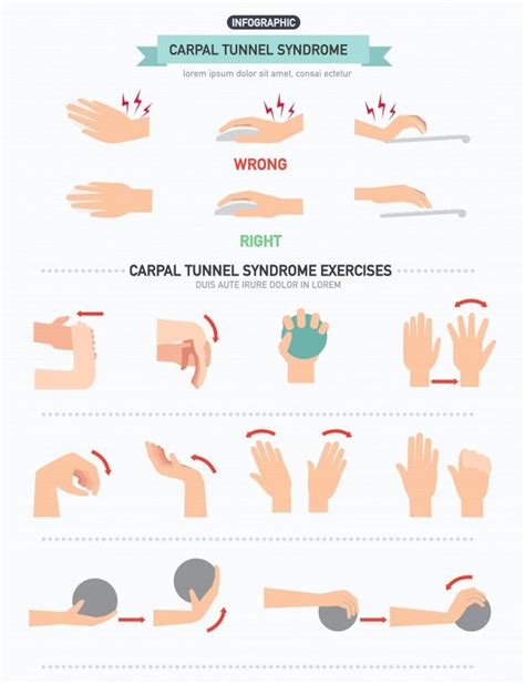Pdf Collection Cubital Tunnel Syndrome Exercises Pdf