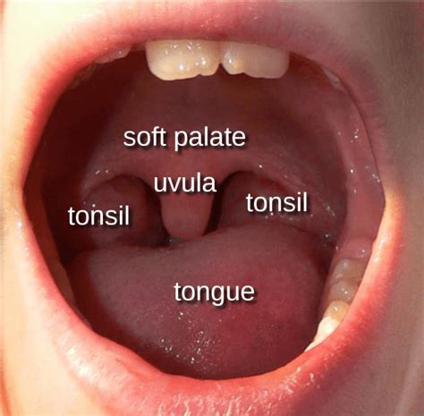 Normal Tonsil