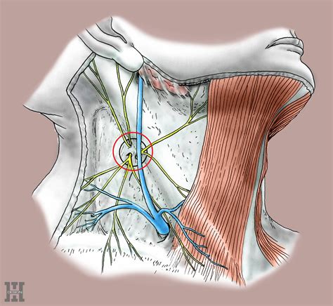 生昇診所 周邊神經擠壓peripheral Nerve Entrapment症候群