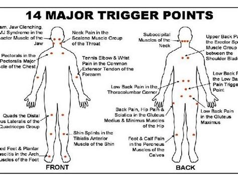 Benefits Of Medical Massage Trigger Points Trigger Point Therapy