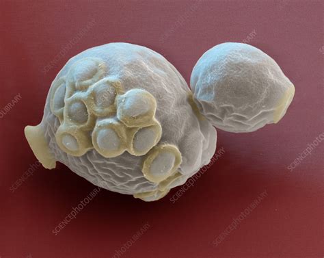 Candida Albicans Yeast Cells Sem Stock Image C0491551 Science