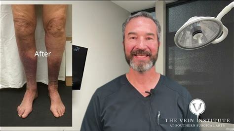 Relief For Tired Legs The Vein Institute At Ssa Youtube