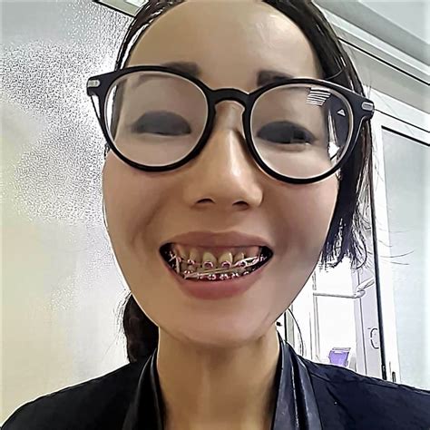 Pin By John Beeson On Rubber Bands In Braces Girls Dental