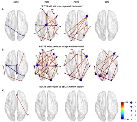 Biomedicines Free Full Text Resting State Eeg Functional