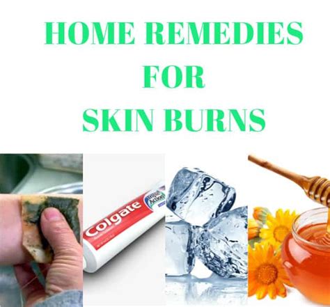 7 Surprising Home Remedies To Heal Skin Burns Indian Beauty Tips