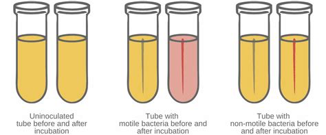 How To Culture Bacteria Integra