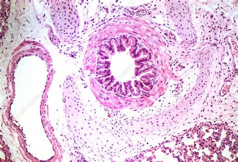 Lm Of A Cross Section Through A Bronchiole In Lung Stock Image P590