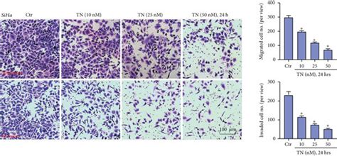 Triptonide Inhibits Human Cervical Cancer Cell Migration And Invasion